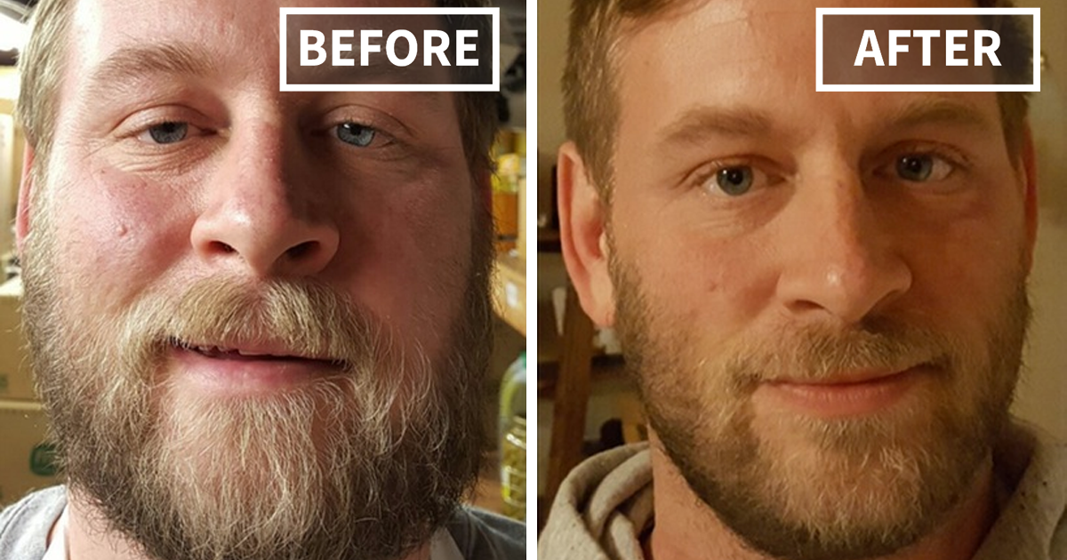 10 Before-And-After Pics Of People Who Gave Up Drinking And